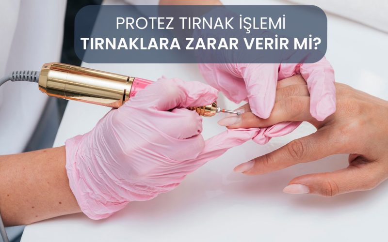 protez-tirnak-nedir